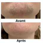 DERMYVA™ Huile visage post-épilation