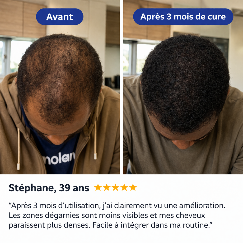 DERMYVA™ Sérum Roll-on Anti-Chute & Stop Calvitie